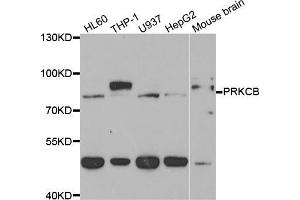 Western blot analysis of extracts of various cell lines, using PRKCB antibody (ABIN5973456) at 1/1000 dilution. (PKC beta Antikörper)