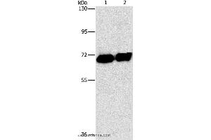 Western blot analysis of HepG2 cell and human placenta tissue, using ALPP Polyclonal Antibody at dilution of 1:1550
