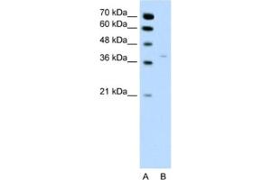 Western Blotting (WB) image for anti-Hydroxysteroid (17-Beta) Dehydrogenase 1 (HSD17B1) antibody (ABIN2462464) (HSD17B1 Antikörper)