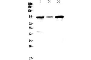 Western blot analysis of GNS using anti-GNS antibody . (GNS Antikörper  (AA 238-355))