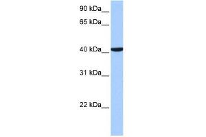 CC2D1B antibody used at 1 ug/ml to detect target protein. (CC2D1B Antikörper  (C-Term))