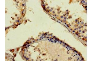 Immunohistochemistry (IHC) image for anti-Amyloid beta (A4) Precursor Protein (APP) (AA 18-270) antibody (ABIN7144042)