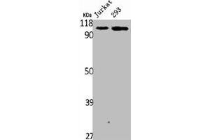 Western Blot analysis of Jurakt 293 cells using Plakophilin 2 Polyclonal Antibody (Plakophilin 2 Antikörper  (C-Term))