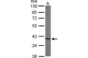 WB Image Sample (50 ug of whole cell lysate) A: Mouse brain 10% SDS PAGE antibody diluted at 1:1000 (TALDO1 Antikörper  (N-Term))