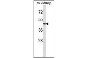 Western blot analysis of ATG4A Antibody  in Mouse kidney tissue lysates (35ug/lane). (ATG4A Antikörper  (C-Term))