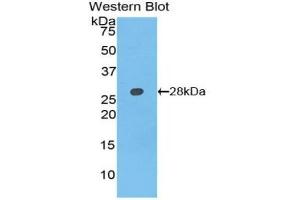 Detection of Recombinant AXIN, Rat using Polyclonal Antibody to Axis Inhibition Protein (AXIN) (Axin Antikörper  (AA 618-827))