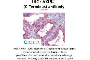 Image no. 2 for anti-Axin 2 (AXIN2) antibody (ABIN1732157) (AXIN2 Antikörper)