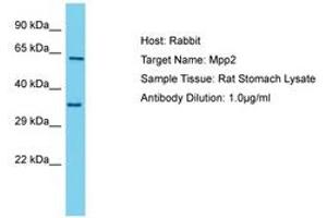 Image no. 1 for anti-Membrane Protein, Palmitoylated 2 (MAGUK P55 Subfamily Member 2) (MPP2) (C-Term) antibody (ABIN6750363) (MPP2 Antikörper  (C-Term))