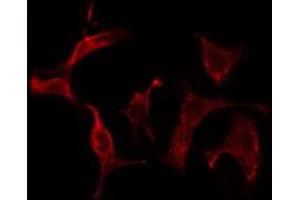 Immunofluorescence (fixed cells) (IF/ICC) image for anti-SHC (Src Homology 2 Domain Containing) Transforming Protein 2 (SHC2) (Internal Region) antibody (ABIN6257771)