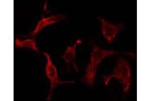 ABIN6275570 staining Hela cells by IF/ICC. (SHC2 Antikörper  (Internal Region))