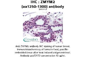 Image no. 1 for anti-Zinc Finger, MYM-Type 2 (ZMYM2) (AA 1250-1300) antibody (ABIN1740931) (ZMYM2 Antikörper  (AA 1250-1300))