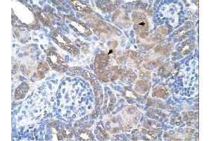 SILV antibody was used for immunohistochemistry at a concentration of 4-8 ug/ml. (Melanoma gp100 Antikörper)