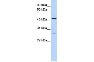 ACBD5 antibody used at 1 ug/ml to detect target protein. (ACBD5 Antikörper  (C-Term))