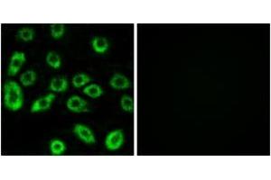 Immunofluorescence analysis of A549 cells, using ATP5D Antibody. (ATP5F1D Antikörper  (AA 61-110))