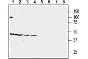 Western blot analysis of human MOLT-4 acute lymphoblastic leukemia (lanes 1 and 5), human CAKI-1 renal cell carcinoma (lanes 2 and 6), human MEG-O1 megakaryoblastic leukemia (lanes 3 and 7) and human COLO-205 colon adenocarcinoma (lanes 4 and 8) cell line lysates: - 1-4. (CRHR2 Antikörper  (Extracellular))