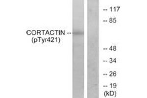 Western blot analysis of extracts from HeLa cells treated with H2O2, using Cortactin (Phospho-Tyr421) Antibody. (Cortactin Antikörper  (pTyr421))