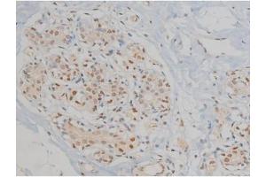 ABIN6267060 at 1/200 staining Human heart tissue sections by IHC-P.