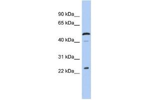 WB Suggested Anti-C1orf190 Antibody Titration: 0.
