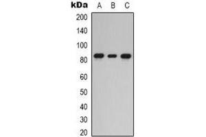 Western blot analysis of PKC epsilon expression in HEK293T (A), Hela (B), HepG2 (C) whole cell lysates. (PKC epsilon Antikörper  (C-Term))