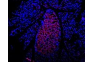 Immunohistochemistry (IHC) image for anti-Purinergic Receptor P2X, Ligand-Gated Ion Channel, 7 (P2RX7) (AA 136-152), (Extracellular) antibody (ABIN7043578)