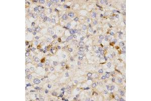 Immunohistochemistry (IHC) image for anti-Nuclear Factor (erythroid-Derived 2)-Like 2 (NFE2L2) (AA 366-605) antibody (ABIN3021832)