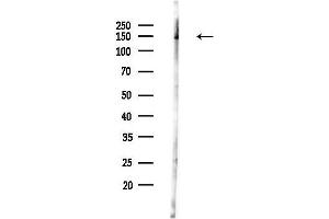 anti-Macrophage Stimulating 1 Receptor (C-Met-Related tyrosine Kinase) (MST1R) (pSer1394) antibody