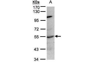 WB Image Sample(30 ug whole cell lysate) A:Raji , 7. (PTPN1 Antikörper)