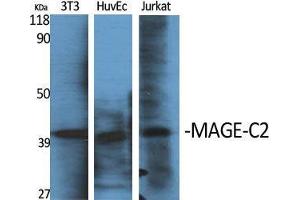 Western Blot (WB) analysis of specific cells using MAGE-C2 Polyclonal Antibody.