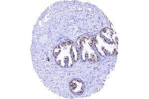 Normal prostate with strong granular perinuclear cytoplasmic prostein staining of luminal cells (Rekombinanter SLC45A3 Antikörper  (N-Term))