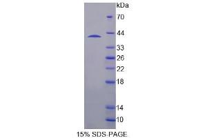 SDS-PAGE analysis of Human SH3BP2 Protein. (SH3BP2 Protein)