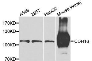 Western blot analysis of extracts of various cell lines, using CDH16 antibody. (Cadherin-16 Antikörper  (AA 19-230))