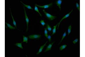 Immunofluorescence staining of Hela cells with ABIN7145246 at 1:133, counter-stained with DAPI. (BBS7 Antikörper  (AA 289-393))