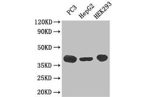 Western Blot Positive WB detected in: PC-3 whole cell lysate, HepG2 whole cell lysate, HEK293 whole cell lysate All lanes: C5AR1 antibody at 3 μg/mL Secondary Goat polyclonal to rabbit IgG at 1/50000 dilution Predicted band size: 40 kDa Observed band size: 40 kDa (C5AR1 Antikörper  (AA 1-36))