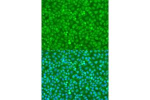 Immunofluorescence analysis of U2OS cells using FOXO3 antibody. (FOXO3 Antikörper  (AA 394-672))