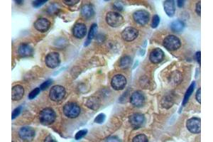Immunohistochemistry (IHC) image for anti-ATP-Binding Cassette, Sub-Family D (Ald), Member 4 (ABCD4) (AA 356-606) antibody (ABIN5013196)