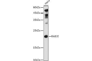 Western blot analysis of extracts of HeLa cells, using R antibody (ABIN6133143, ABIN6146576, ABIN6146578 and ABIN6224057) at 1:1000 dilution. (RAB35 Antikörper  (AA 1-201))