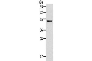 Gel: 8 % SDS-PAGE,Lysate: 40 μg,Primary antibody: ABIN7131486(TRIM49 Antibody) at dilution 1/800 dilution,Secondary antibody: Goat anti rabbit IgG at 1/8000 dilution,Exposure time: 3 seconds (TRIM49 Antikörper)