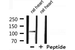 Western blot analysis of extracts from rat heart, using XPF Antibody. (ERCC4 Antikörper  (C-Term))