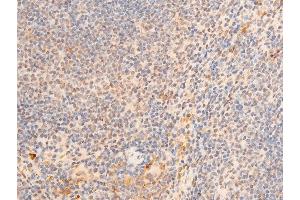 Immunohistochemistry (IHC) image for anti-Lamin A/C (LMNA) (pSer392) antibody (ABIN6256311)