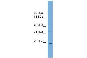 WB Suggested Anti-CTF1  Antibody Titration: 0. (Cardiotrophin 1 Antikörper  (N-Term))