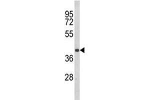 Western blot analysis of CCR3 antibody and Jurkat lysate. (CCR3 Antikörper  (AA 291-318))