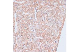 Immunohistochemistry of paraffin-embedded rat heart using MZB1 antibody (ABIN7268403) at dilution of 1:100 (40x lens). (MZB1 Antikörper  (AA 1-189))