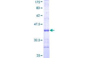 Image no. 1 for Interleukin 1 Receptor, Type II (IL1R2) (AA 21-120) protein (GST tag) (ABIN1307757) (IL1R2 Protein (AA 21-120) (GST tag))