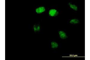 Immunofluorescence of purified MaxPab antibody to ZBTB3 on HeLa cell.