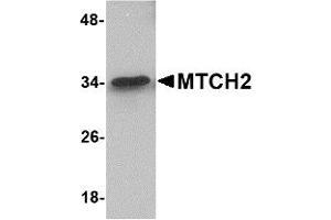 Western Blotting (WB) image for anti-Mitochondrial Carrier 2 (MTCH2) (N-Term) antibody (ABIN1031463) (MTCH2 Antikörper  (N-Term))