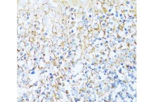 Immunohistochemistry of paraffin-embedded Human tonsil using NDUFA5 Polyclonal Antibody at dilution of 1:100 (40x lens). (NDUFA5 Antikörper)