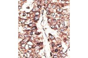 Image no. 1 for anti-Melanoma Antigen Family A, 11 (MAGEA11) (N-Term) antibody (ABIN358642) (MAGEA11 Antikörper  (N-Term))