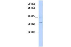 WB Suggested Anti-SIRT5 Antibody Titration:  0. (SIRT5 Antikörper  (Middle Region))
