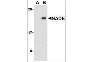 Western blot analysis of NADE in Human brain cell lysates with this product at 1 μg/ml in the presence (A) or absence (B) of blocking peptide. (Nerve Growth Factor Receptor (TNFRSF16) Associated Protein 1 (NGFRAP1) (Middle Region) Antikörper)