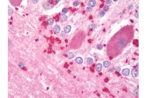 Immunohistochemistry (IHC) image for anti-Protein Phosphatase 3, Catalytic Subunit, alpha Isoform (PPP3CA) (AA 364-283) antibody (ABIN1926038)